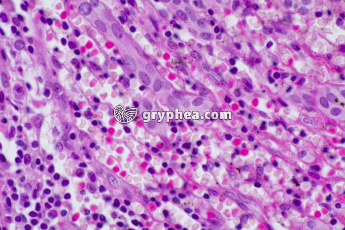 Foie Homme x200 - gryphea.org